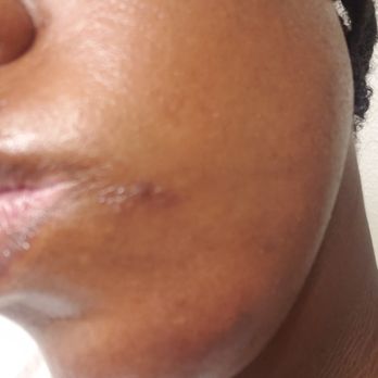 Ibeauty Med Spa - Medical Spas Near Me - Garland, Texas Ibeauty Med Spa - Medical Spas Near Me - Garland, Texas