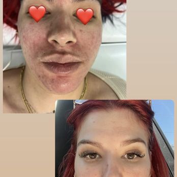 Firm Sculpt Aesthetics - Results - Cosmetic Surgeons Near Me - Las Vegas, Nevada Firm Sculpt Aesthetics - Results - Cosmetic Surgeons Near Me - Las Vegas, Nevada