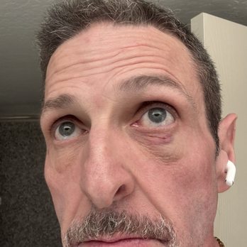 Circus Circus Reno - A Caesars Rewards Destination - Black eye with split eye lid - Hotels Near Me - Reno, Nevada