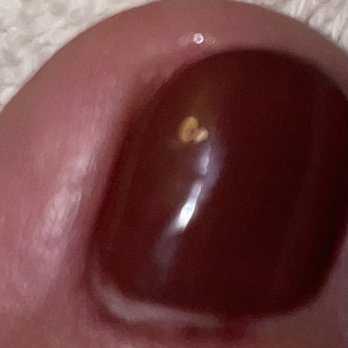 Solo Nails - My whole cuticle is scarred from bleeding - Nail Salons Near Me - Los Angeles, California Solo Nails - My whole cuticle is scarred from bleeding - Nail Salons Near Me - Los Angeles, California