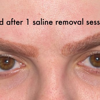 Azalon Aesthetics - Medical Spas Near Me - Yukon, Oklahoma Azalon Aesthetics - Medical Spas Near Me - Yukon, Oklahoma