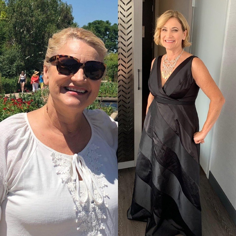 PASADENA WEIGHT LOSS CENTER 94 Photos & 107 Reviews 600 S Lake Ave