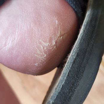 Vip Nails - This is what my heels look like afterwards - Nail Salons Near Me - Durango, Colorado