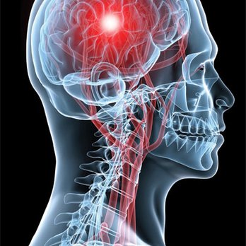 Virtual Physical - Brain Scan/Total Body - Diagnostic Imaging Near Me - Rockville, Maryland