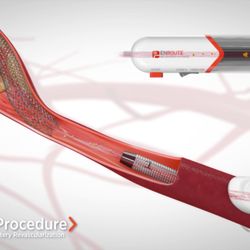 Rameen Moridzadeh, MD - Varicose Vein & Vascular Specialist