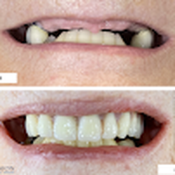 Precision Dental Specialties
