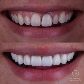 Ember Dental - General Dentistry Near Me - Deerfield Beach, Florida Ember Dental - General Dentistry Near Me - Deerfield Beach, Florida