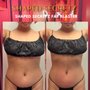 Photo of Shaped Secretz Body Sculpting