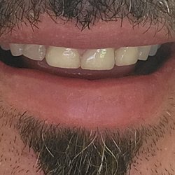 Chino Aesthetic Dental - After.