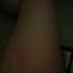 Kim's Nails - Burns