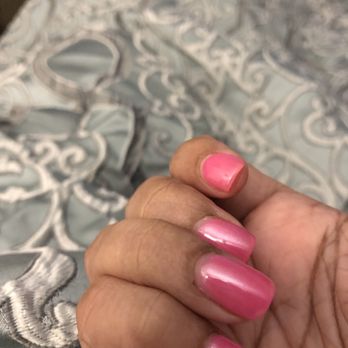 Miracle Nails - Cut cuticle with scab - Nail Salons Near Me - San Antonio, Texas Miracle Nails - Cut cuticle with scab - Nail Salons Near Me - San Antonio, Texas