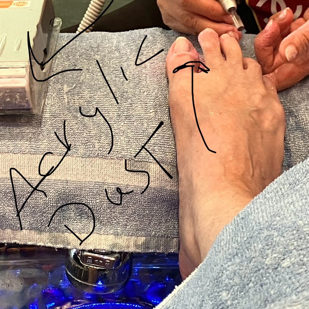 Vanity Nails & Spa - Sanded toes and painted clear over sanded area not cleaning the sand off first ( you can see this in the photo and the sander all dirty) - Nail Salons Near Me - Las Vegas, Nevada Vanity Nails & Spa - Sanded toes and painted clear over sanded area not cleaning the sand off first ( you can see this in the photo and the sander all dirty) - Nail Salons Near Me - Las Vegas, Nevada