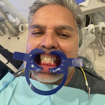 The Brighter Smiles - Before - Dental Hygienists Near Me - San Jose, California The Brighter Smiles - Before - Dental Hygienists Near Me - San Jose, California