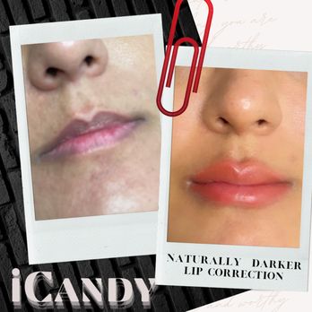 iCandy Academy - Lip Blush - Permanent Makeup Near Me - Austin, Texas iCandy Academy - Lip Blush - Permanent Makeup Near Me - Austin, Texas