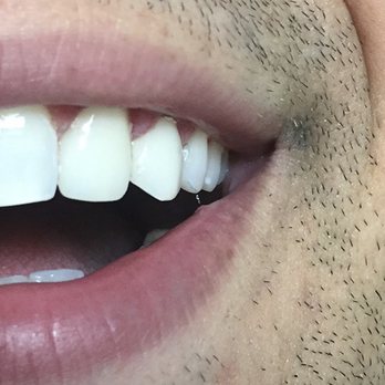 Suri Dental Group - General Dentistry Near Me - East Rockaway, New York Suri Dental Group - General Dentistry Near Me - East Rockaway, New York