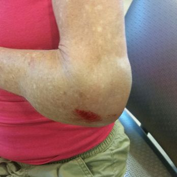 DeVille Law Group - Personal Injury Law Near Me - Bakersfield, California