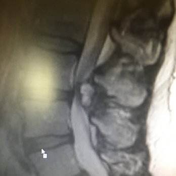 Burdi Michael D MD - Orthopedists Near Me - Mission Viejo, California