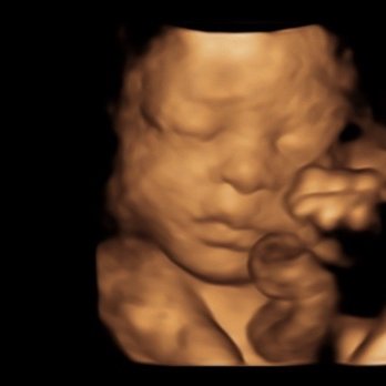 The Baby Connection - Diagnostic Imaging Near Me - Sacramento, California The Baby Connection - Diagnostic Imaging Near Me - Sacramento, California