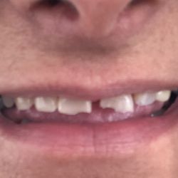 Advanced Waltham Dental - Before