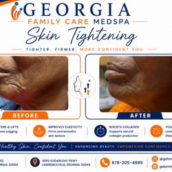 Georgia Family Care - Achieve firmer, smoother skin with skin tightening in Lithonia. Boost collagen and reveal a more youthful look.