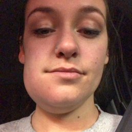 This is how swollen I was before he helped me! It immediately went down after him helping me! This is how swollen I was before he helped me! It immediately went down after him helping me!