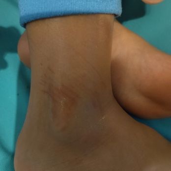 Jump For Fun - scratches from slide - Party Supplies Near Me - Tampa, Florida