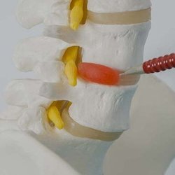 Pain MD - PAIN MD is a Pain Management Specialist serving Scottsdale, AZ