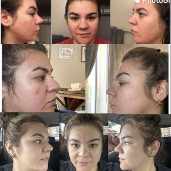 The Healing Square - Skin Care Near Me