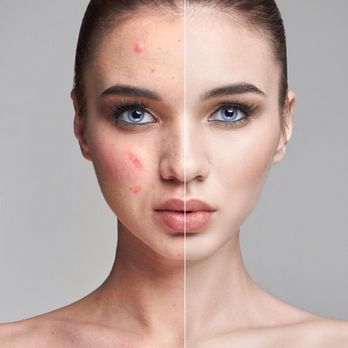 Lux Skin Solutions - Logo - Skin Care Near Me - Centennial, Colorado Lux Skin Solutions - Logo - Skin Care Near Me - Centennial, Colorado