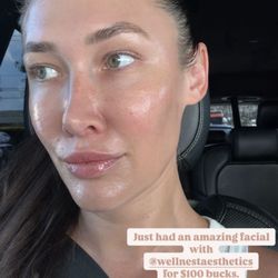 Wellnest Aesthetic Lounge - Glass skin