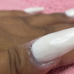 Produce around my skin