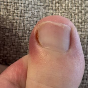 Nails 19 - I visited the salon. It was terrible, they gave me an infection, my finger is swollen, and there is pus. I had to undergo a long treatment. - Nail Salons Near Me - Roseville, California