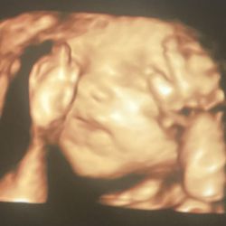 Blessings 3D 4D Ultrasound