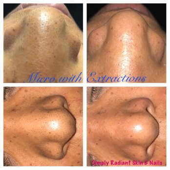 Simply Radiant Skin & Nails - Skin Care Near Me - Raleigh, North Carolina Simply Radiant Skin & Nails - Skin Care Near Me - Raleigh, North Carolina