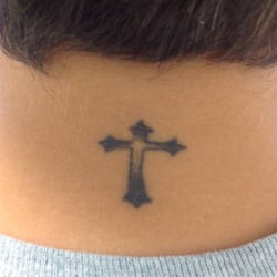 Removery Tattoo Removal & Fading - Before Treatment