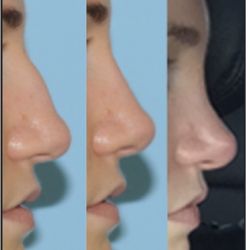 Monica Tadros Center for Sinus, Sleep, & Facial Plastic Surgery