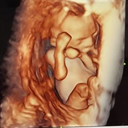 Image N You Ultrasound Studio - Baby cuddled up in the uterus :) 3D ultrasound