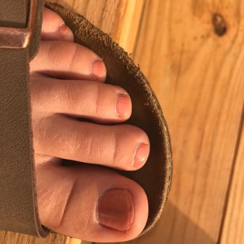 Nails By Elizabeth - It made me have a wart on my toe - Hair Extensions Near Me - Spartanburg, South Carolina Nails By Elizabeth - It made me have a wart on my toe - Hair Extensions Near Me - Spartanburg, South Carolina