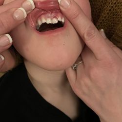 Pediatric Dental Care of Wilmington - Sons teeth