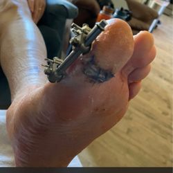 Artisan Foot and Ankle Specialists