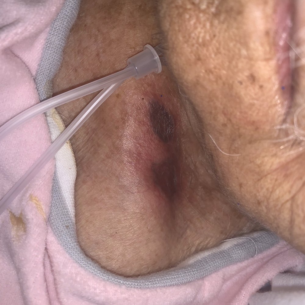 Warren Barr Lieberman - Over a month of neglect. - Rehabilitation Center Near Me - Skokie, Illinois Warren Barr Lieberman - Over a month of neglect. - Rehabilitation Center Near Me - Skokie, Illinois