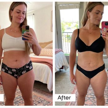 BelleSculpt - Body Contouring Near Me - Tulsa, Oklahoma BelleSculpt - Body Contouring Near Me - Tulsa, Oklahoma