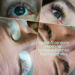 Beyond Esthetics MedSpa