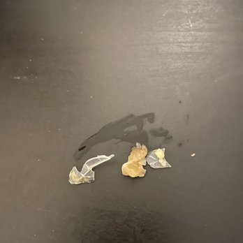 Bondi - Plastic shards in Yellowtail Jalapeno roll - Sushi Bars Near Me - New York, New York