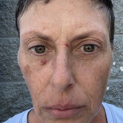 Monument Police Department - Those marks on my face are from the fingernails of the person who assaulted me.