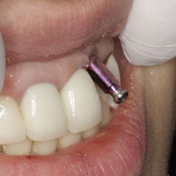 Douglas L Trippel, DDS PS - General Dentistry Near Me - Bellevue, Washington