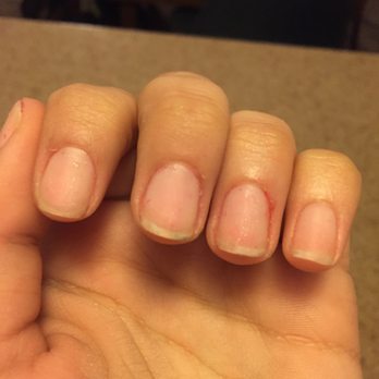 Luv Nails & Spa - These are my nails when I LEFT Luv Nails. Completely destroyed. I cleaned it off, but you can tell my ring finger was bleeding. NEVER AGAIN. - Nail Salons Near Me - Costa Mesa, California Luv Nails & Spa - These are my nails when I LEFT Luv Nails. Completely destroyed. I cleaned it off, but you can tell my ring finger was bleeding. NEVER AGAIN. - Nail Salons Near Me - Costa Mesa, California