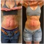 Photo of Contour Body Aesthetics