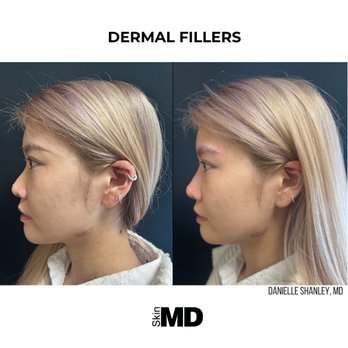 Skin MD - Laser Hair Removal Near Me - Hanover, Massachusetts Skin MD - Laser Hair Removal Near Me - Hanover, Massachusetts