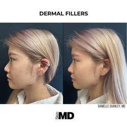 Skin MD